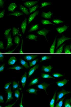 B2M/Beta 2 Microglobulin Antibody