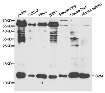 B2M/Beta 2 Microglobulin Antibody