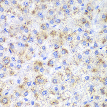 HAO1 Antibody