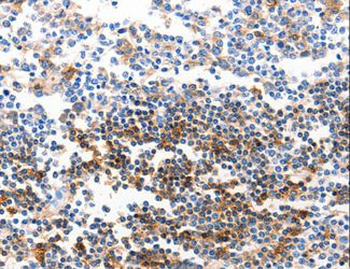 GJB6/CX30/Connexin 30 Antibody