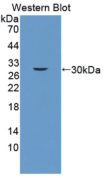 MYLK3 Antibody