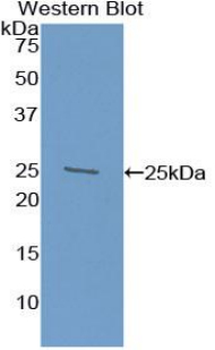 SPON1/F-Spondin Antibody