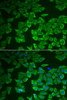 CRHBP Antibody