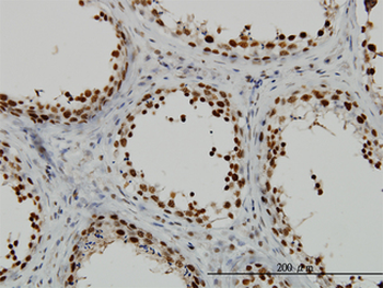 RAD18 Antibody