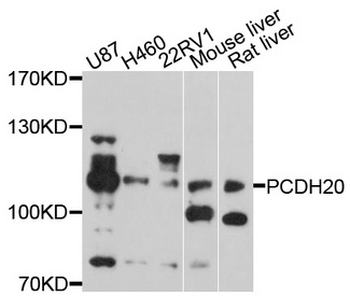 PCDH20 Antibody