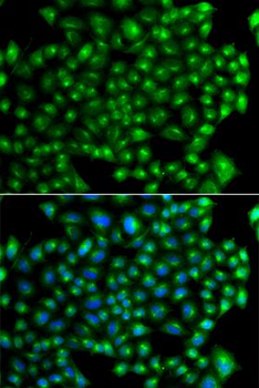 ZFYVE1/DFCP1 Antibody