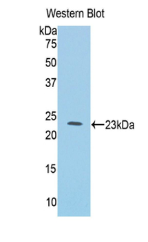 IL1RL1 Antibody