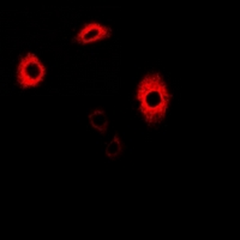 GATM/AGAT Antibody