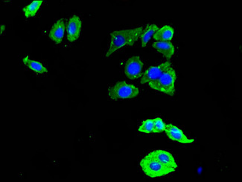 DDR2 Antibody