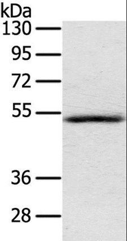 IL17RB Antibody