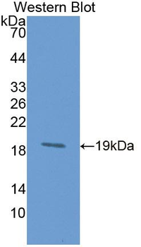 PDPN/Podoplanin Antibody
