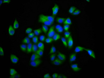 FBP/FOLR2 Antibody