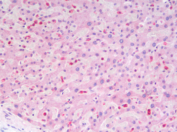 ITGAX/CD11c Antibody