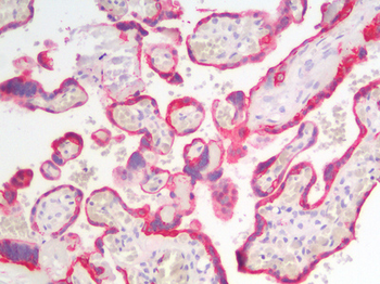 KRT18/CK18/Cytokeratin 18 Antibody
