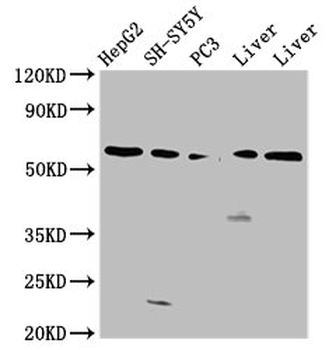 UGT1A/UGT1A1 Antibody