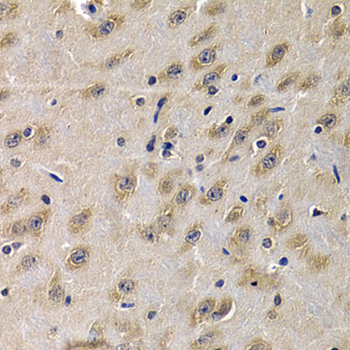 Complement C1QA Antibody