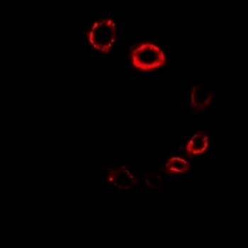 HMG-CoA Reductase/HMGCR Antibody