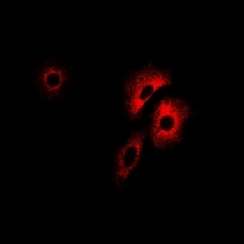 PCCB Antibody