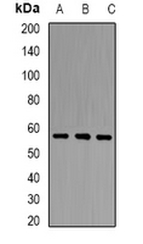 PCCB Antibody