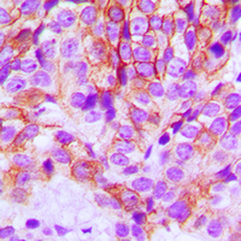 CDH1/E Cadherin Antibody