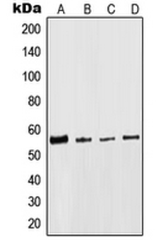 KRT8/CK8/Cytokeratin 8 Antibody
