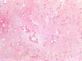 F3/CD142/Tissue factor Antibody