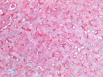 CD14 Antibody