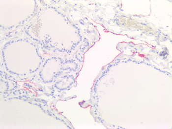PDPN/Podoplanin Antibody