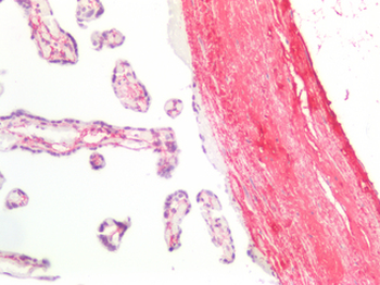CTx-I Antibody