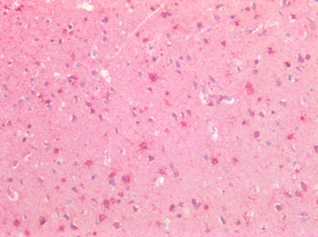 SLIT3 Antibody