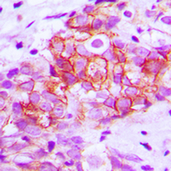 CDH1/E Cadherin Antibody