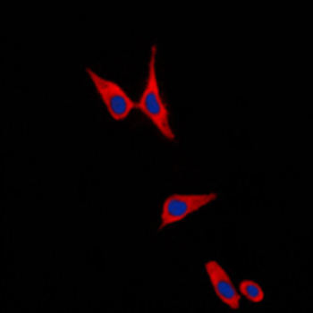 CDH1/E Cadherin Antibody