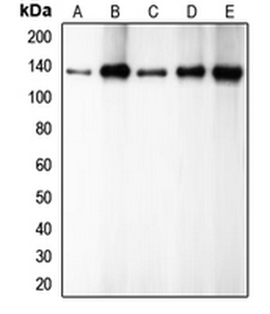 CDH1/E Cadherin Antibody