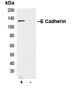 CDH1/E Cadherin Antibody