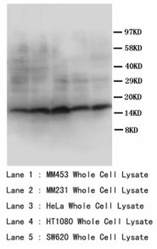 SST/Somatostatin Antibody