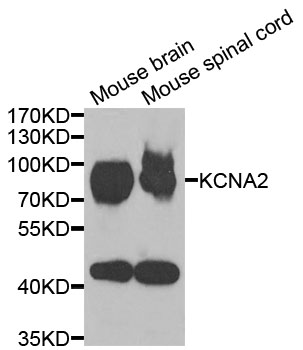 KCNA2/Kv1.2 Antibody