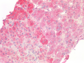 CD95/FAS Antibody