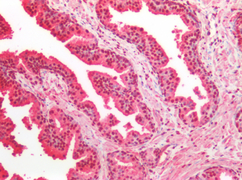 GAPDH Antibody