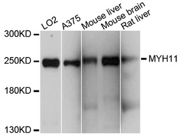 SMMHC/MYH11 Antibody