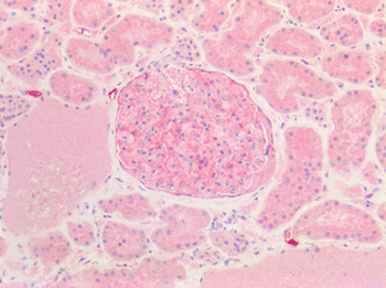 PDPN/Podoplanin Antibody
