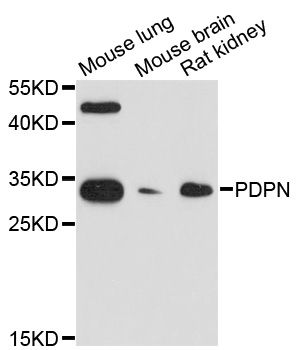 PDPN/Podoplanin Antibody