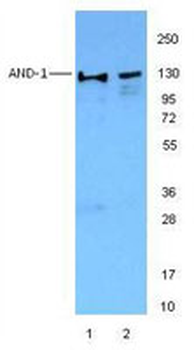 WDHD1 Antibody