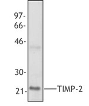 TIMP2 Antibody