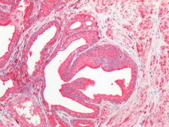 CFL2/Cofilin 2 Antibody