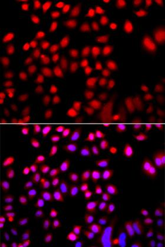 CFL2/Cofilin 2 Antibody