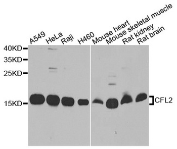 CFL2/Cofilin 2 Antibody