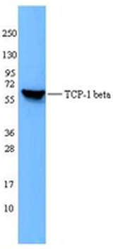 CCT2/CCT Beta Antibody