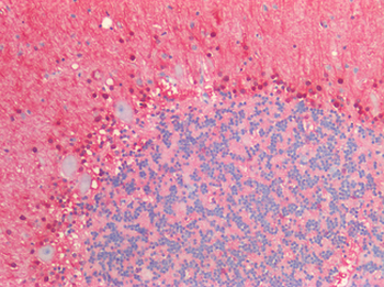 S100B/S100 Beta Antibody