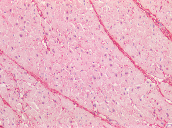 CTGF Antibody