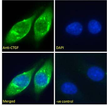CTGF Antibody